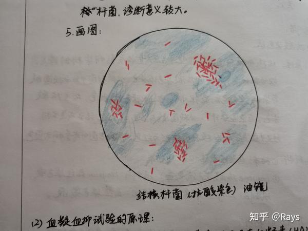 6.结核杆菌抗酸染色