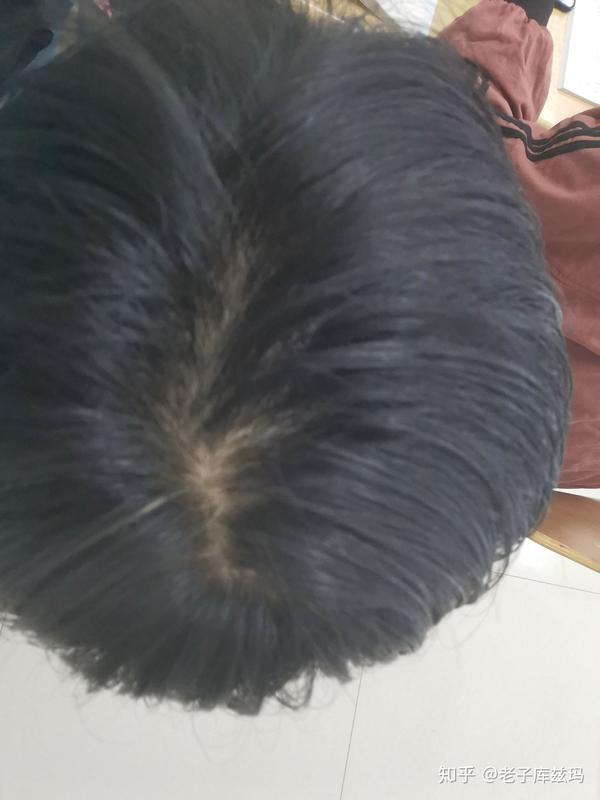 头发发旋 - 知乎