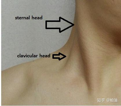 当我们将头转向一侧时,对侧的胸锁乳突肌会被凸显出来.