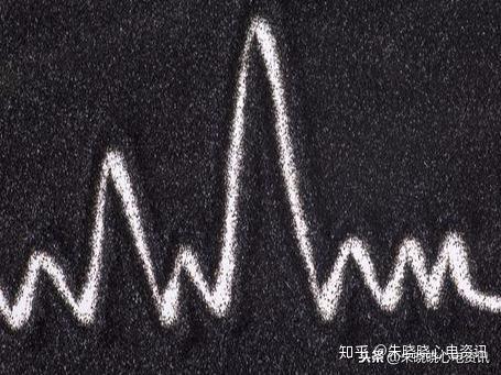 心悸是种什么感觉