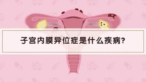 子宫内膜异位症是什么?怎么治疗?能通过试管怀孕吗?