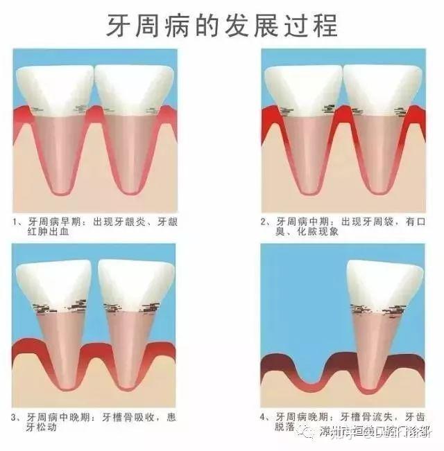 牙龈出血天天喝自己的血会怎么样(少量)?