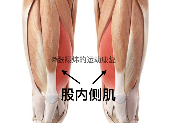 正常情况下,股内侧肌可以拉住膝盖骨,让膝盖骨在大腿骨的凹槽里滑动