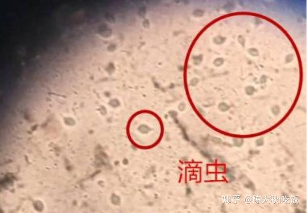 猫主要感染三毛滴虫,犬主要感染贾第虫鞭毛虫 四,预防与治疗 预防