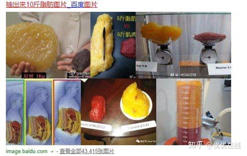 抽出来10斤脂肪图片大概什么样