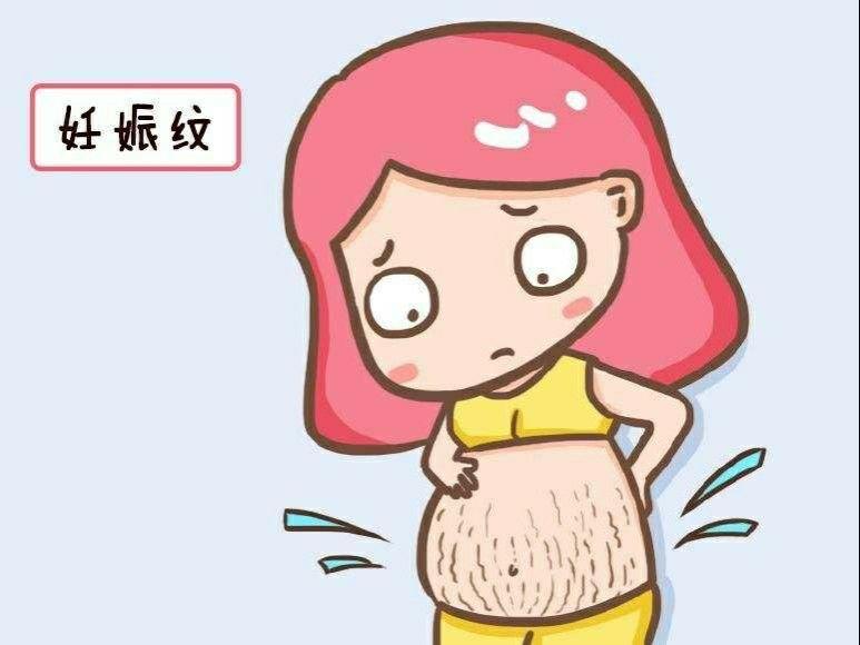 妊娠纹能去掉吗宝妈们都在用这个去妊娠纹