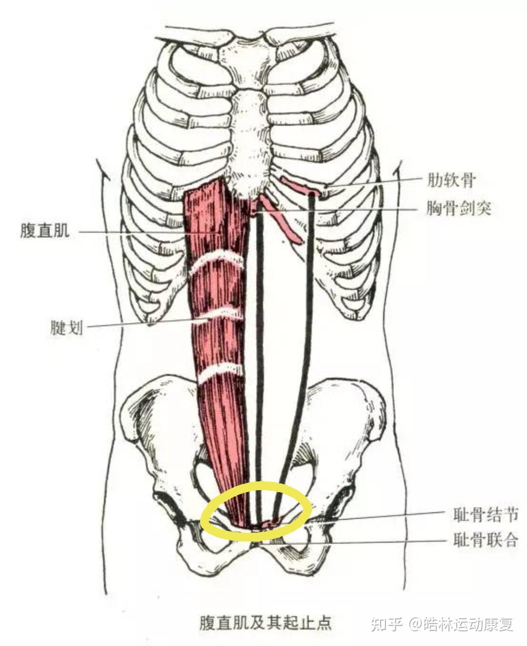 用双手指腹按压肋骨下缘腹直肌上端附着处,按压3-5分钟,以局部疼痛