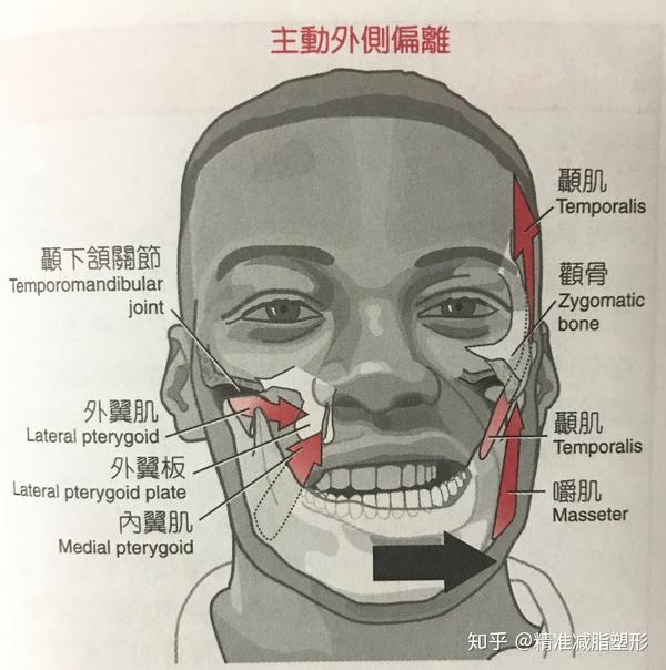 左右脸不一样大,严重的还有高低眉,颧骨不对称,鼻子歪,高低嘴唇等问题