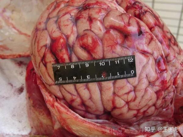 质证尸语者之"人肉罐头"