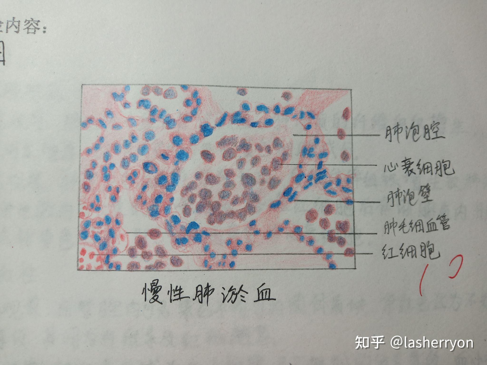 病理红蓝铅笔手绘图