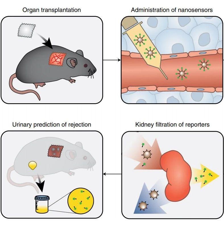 nature子刊通过尿液检测早期器官移植排斥反应