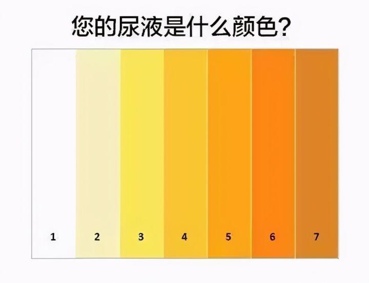 尿液颜色黄是肾不好排除这3个原因最好还是去查查吧