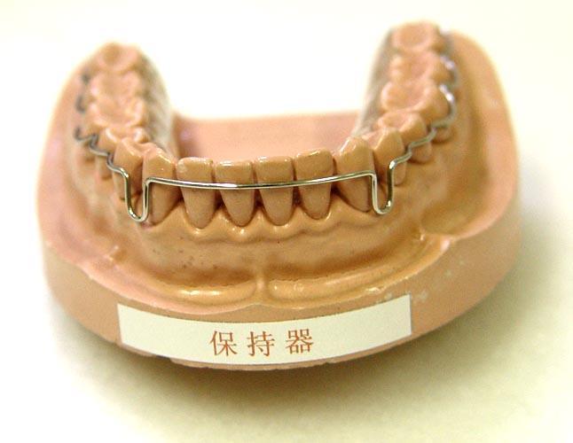 牙齿矫正结束后为什么要带保持器导致牙齿反弹的原因是