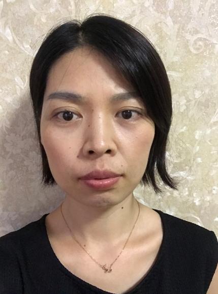 素人改造鼻孔外漏被评为全班最丑女生的姑娘能美成什么样