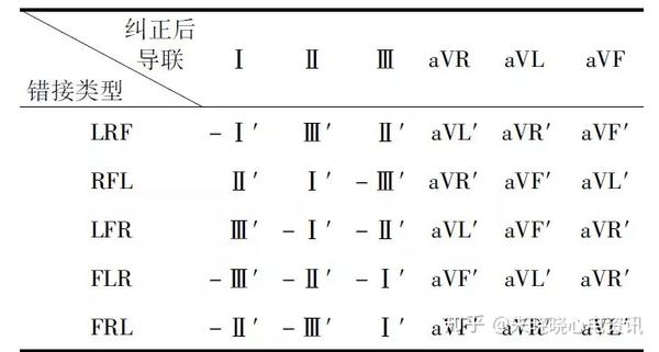 利用einthoven三角定律判断心电图肢体导联错接