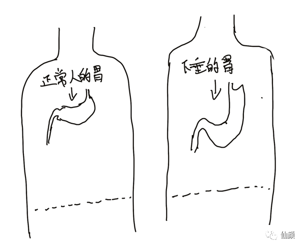 饭后运动是活到九十九还是胃下垂