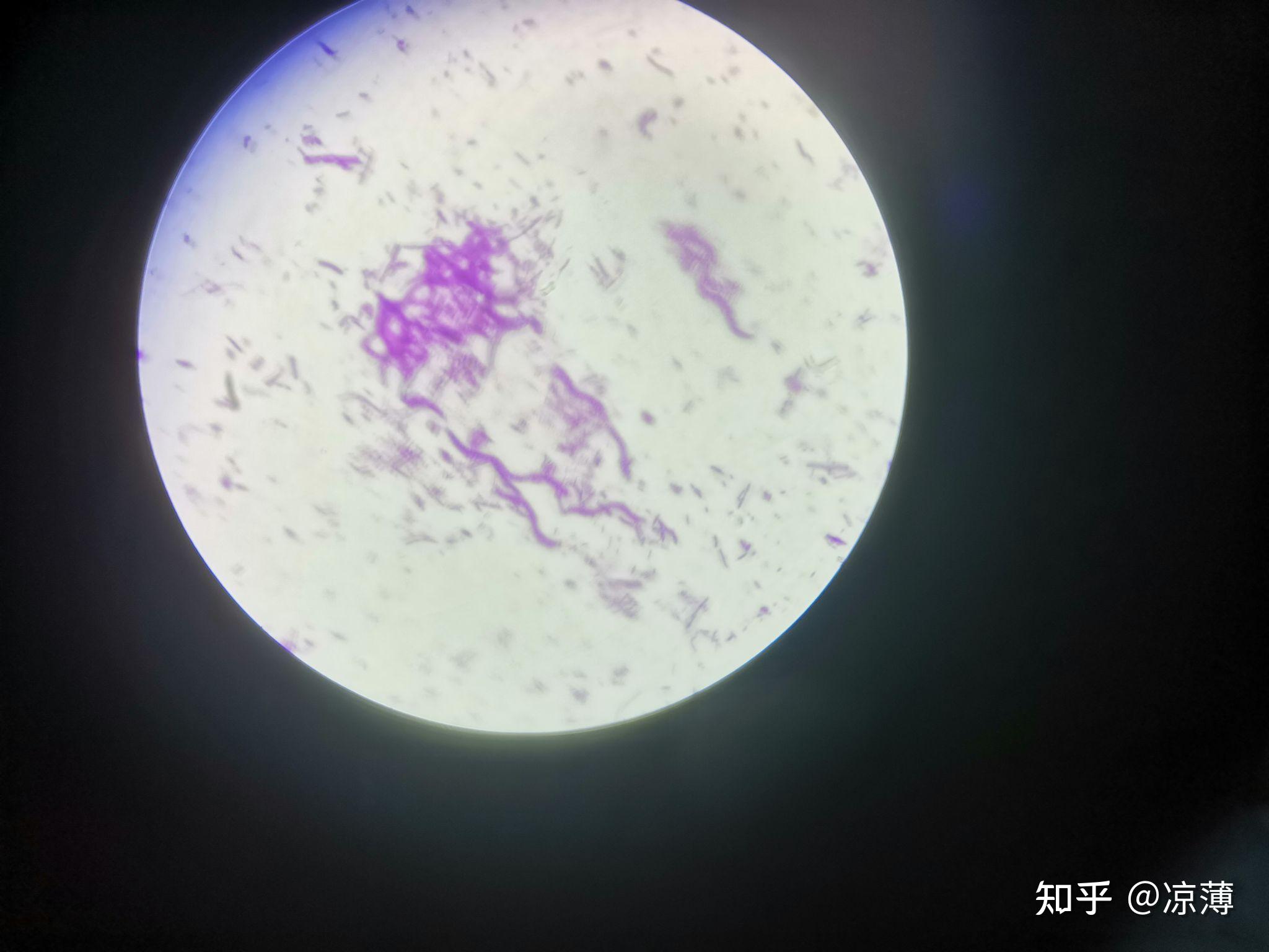 显微镜下观察的细菌三型涂片是怎样的