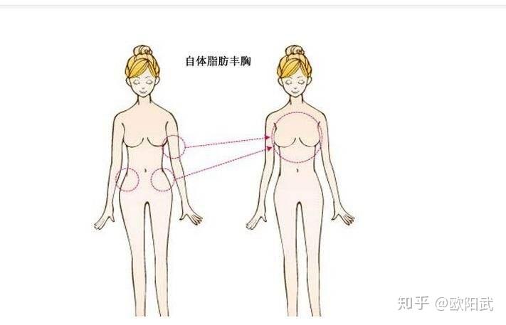 1,胸部发育扁平,或者乳房松弛下垂,但腰腹,下半身脂肪较多的女性.