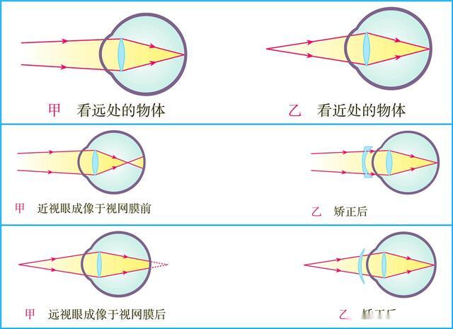 中考物理一轮复习归纳:近视眼和远视眼的成因与矫正!