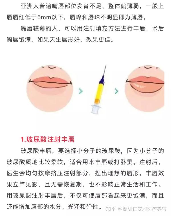 唇形特点:嘴角上扬,上唇有明显的m弓形 代表女星:angelababy徐子淇