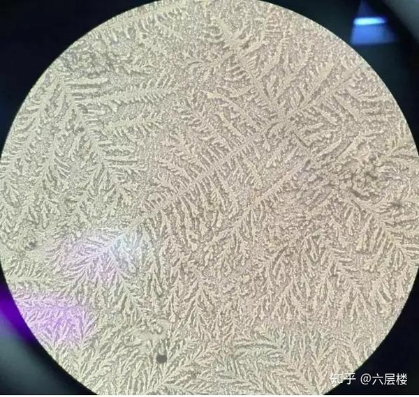 宫颈黏液在镜下出现有羊齿植物叶状结晶,通常出现在排卵期,也是用来