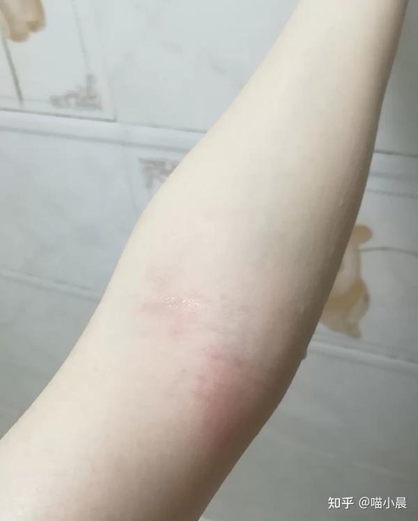 搓澡巾搓的,是真疼.