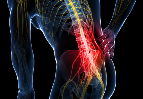 女性后腰下部经常疼痛除了考虑腰肌劳损,椎间盘突出外,还考虑妇科病变