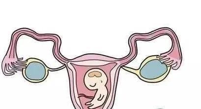 而正常的妊娠应该是受精卵着床于子宫宫腔里面