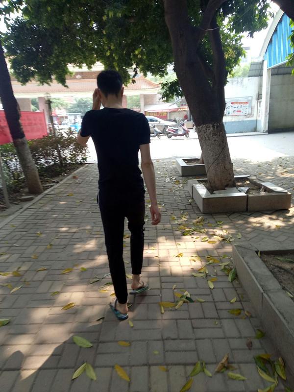 皮肤差的胖女孩会有男生喜欢吗?