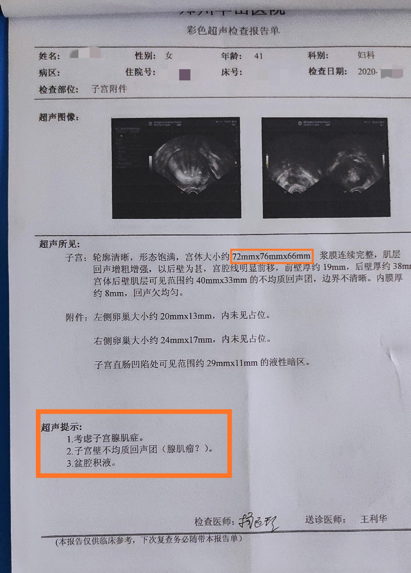 b超单子上有这几个提示说明是子宫腺肌症