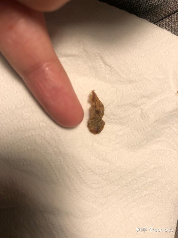 感觉这是发霉吗?