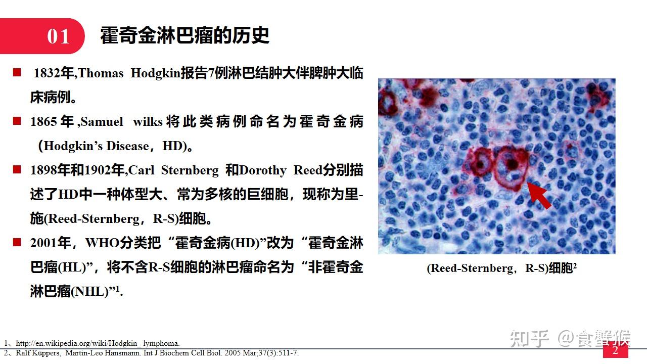 霍奇金淋巴瘤简介