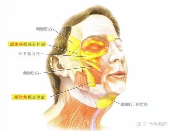 脂肪型的大脸如何瘦?面部吸脂术有绝招