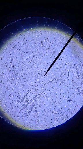 精子可以用普通的光学显微镜观察到么?
