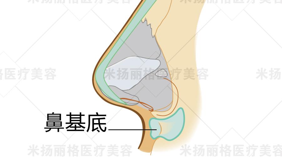 鼻整形不要忽略一个重要的点:鼻基底整形!