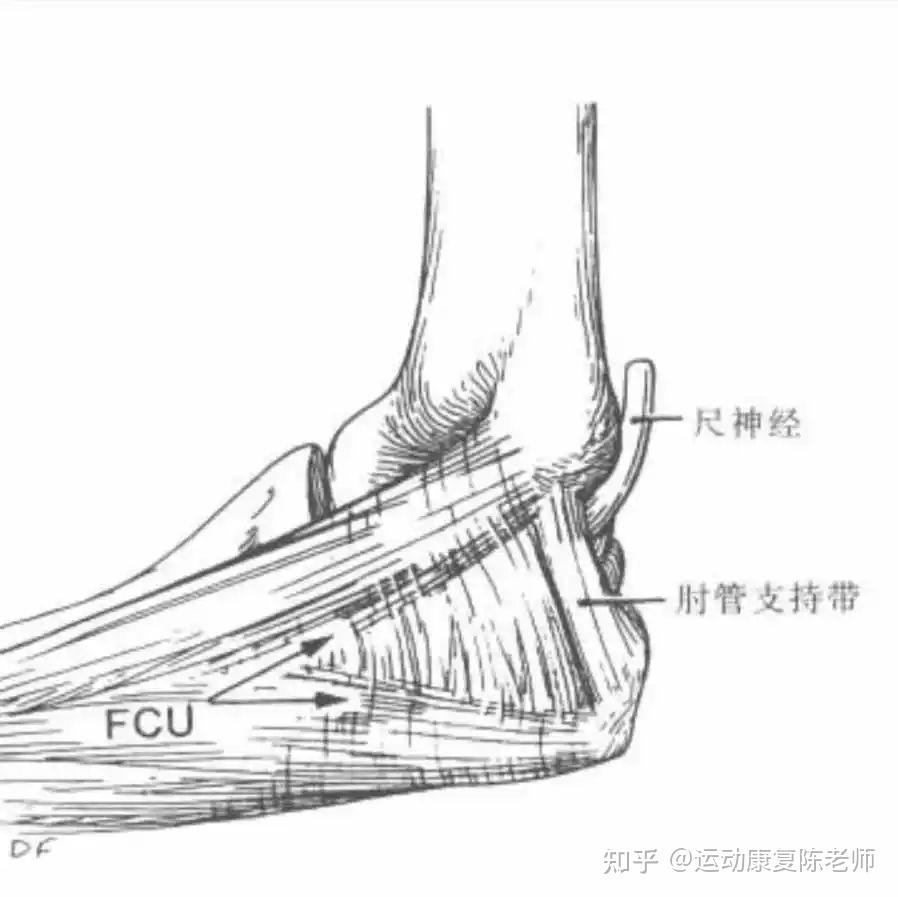 什么是肘管综合征