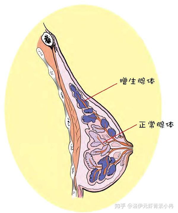 检查时会发现增生结节大小不一,与周围组