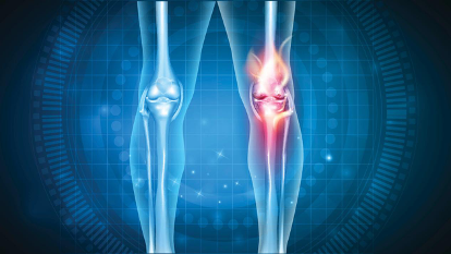 薰衣草精油按摩对膝骨关节炎的疗效一项随机对照临床试验