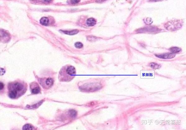 细胞呈圆形或卵圆形;核圆形,偏于一侧;染色质粗大,多沿着