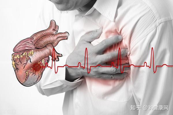 突发心脏病阿司匹林硝酸甘油速效救心丸吃哪种药物能救命