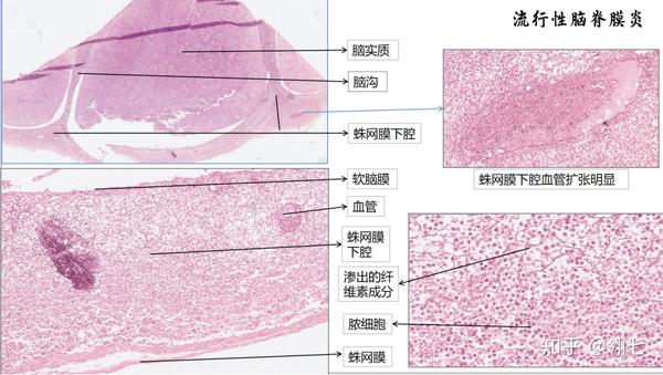 1.4切片典型图片(图片位置不要超过第2页,且小于4m)