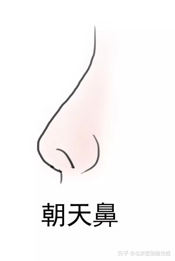 常见七种不完美鼻型,快进来看你属于哪一种