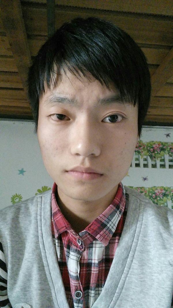 为什么很多人都有左右脸,以及大小眼,甚至有的鼻子大小都不一样的情况