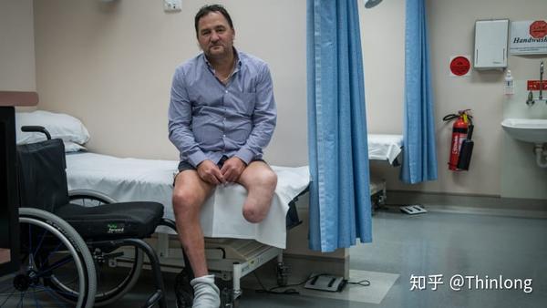 给糖尿病人截肢20多年 由于主修骨科和整形,gary fettke毕业后,很顺利