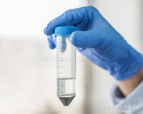 试管婴儿移植后需要静躺多久啊