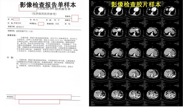 让癌症原形毕露的医学影像检查ctmripet等概述篇