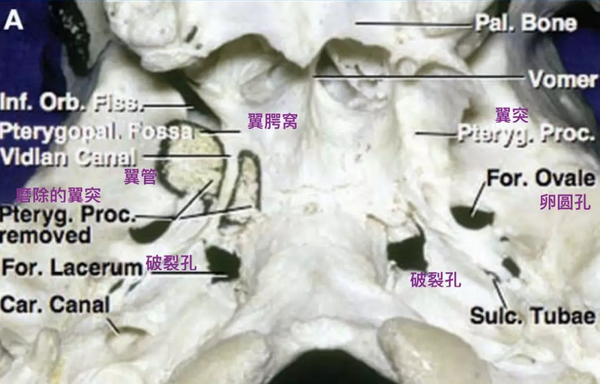 岩大神经(greater petrosal nerve)发自膝状神经节(geniculate