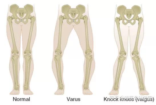 下肢关节示意图(从左至右分别为a,b,c)