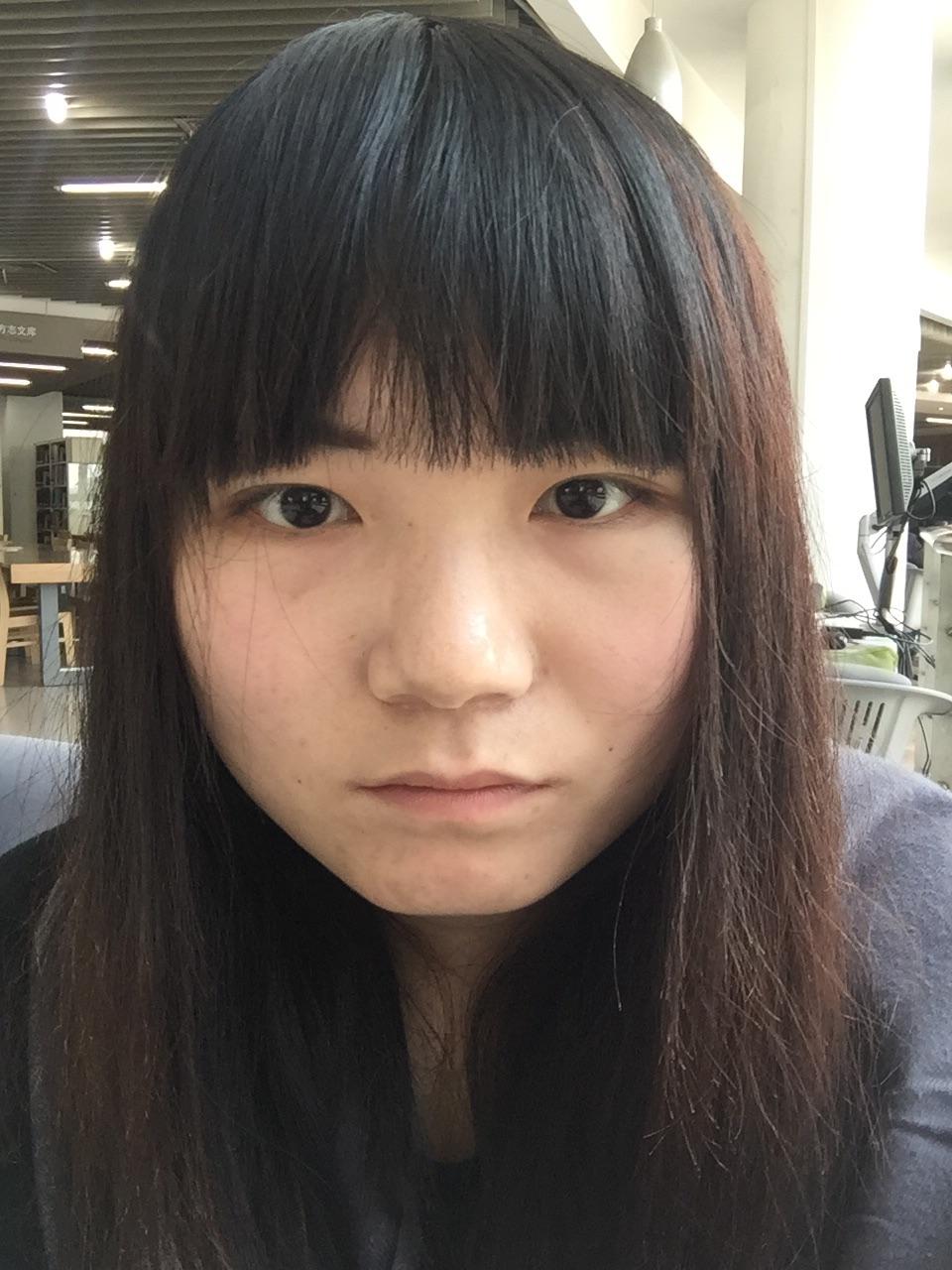 重64kg,26岁,长期熬夜,皮肤明显,体重下垂,现在眼袋v皮肤率肥图片