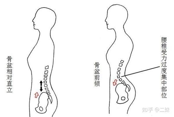 其中,髋骨由髂骨,坐骨和耻骨三块骨骼组成.